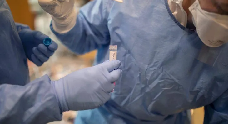 Un equipo de científicos demuestra que anticuerpos de un paciente recuperado bloquean el coronavirus