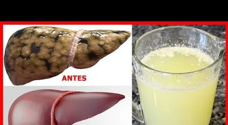 Cinco alimentos para curar para siempre el Hi­gado Graso y dejarlo como nuevo
