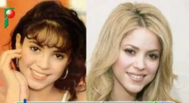 Famosas Latinas antes y después de la cirugía
