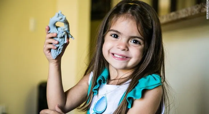 Un corazón impreso en 3D cambia la vida a una niña