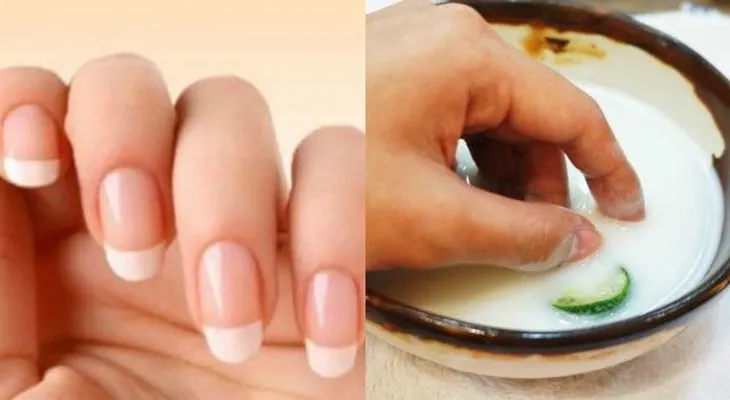 Si lo coloca en las uñas 15 minutos tus hongos desaparecerán 