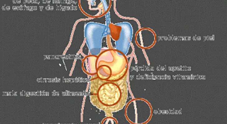 Exceso de alcohol aumenta el riesgo de sufrir Alzheimer y Parkinson