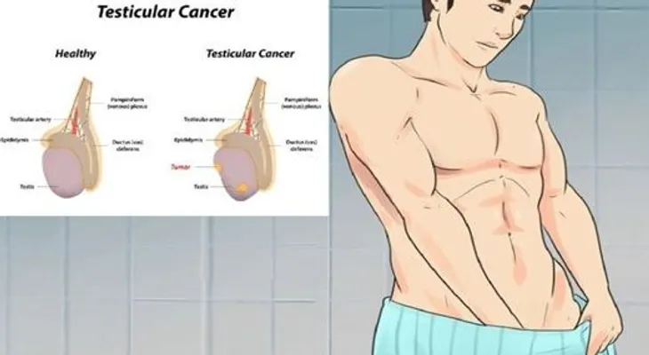 5 signos de cáncer testicular que la mayoría de hombres les da vergüenza hablar