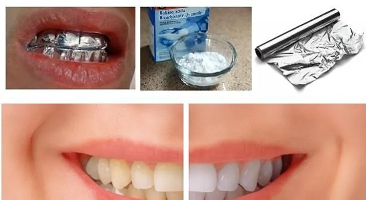  Mira qué pasa cuando envuelves tus dientes con papel de aluminio