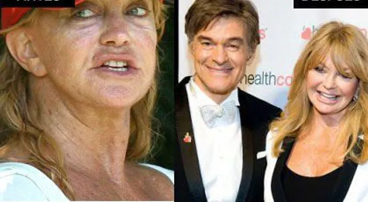 El Increíble Secreto de las celebridades para lucir 20 Años Más Joven!