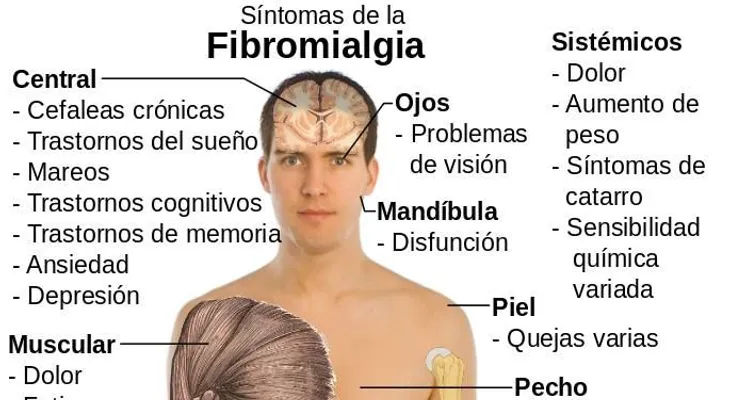 Consumir ciertas cepas de probióticos pueden ser beneficios para personas con fibromialgia