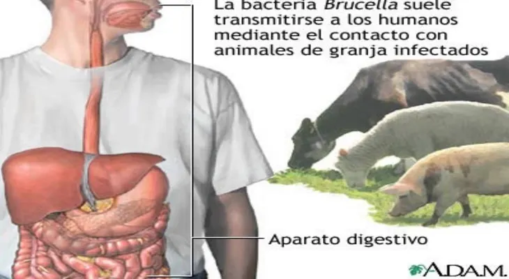 Brucelosis humana, canina y bovina: tratamiento, síntomas, causas