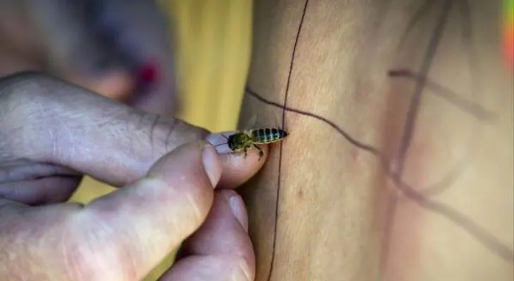 El veneno de las abejas se utiliza para tratar la artritis o la psoriasis