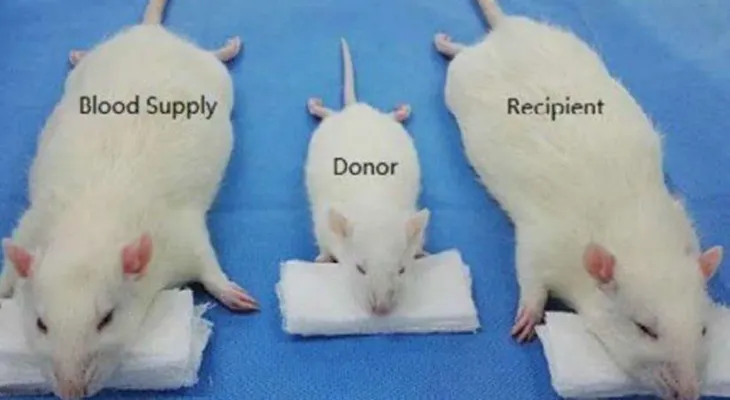 El polémico experimento del médico que quiere realizar el primer trasplante de cabeza entre seres humanos