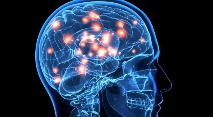 Desarrollan un "marcapasos cerebral" para tratar la epilepsia