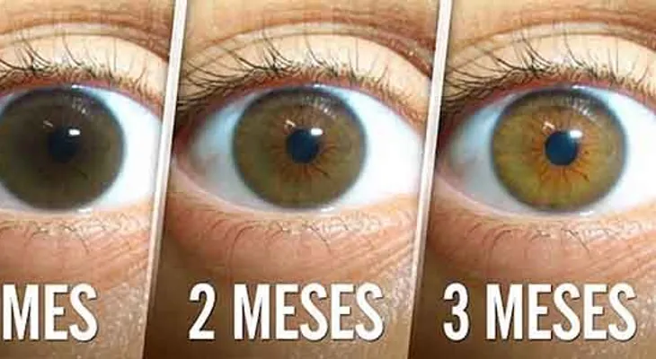 Aumenté mi visión en 3 meses y evité una cirugía con esta simple receta natural