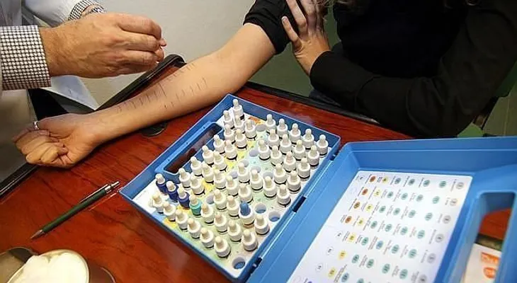 Las alergias alimentarias se previenen desde bebés