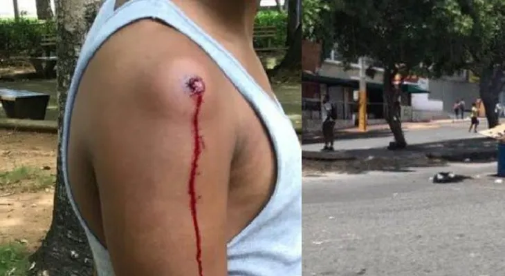  Hieren de bala dirigente estudiantil en medio de disturbios en la UASD 