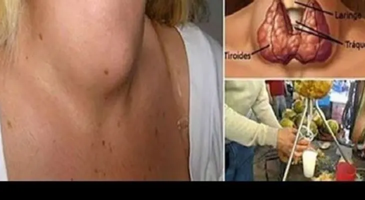 Tiroides feliz: El secreto que tu médico no te dirá