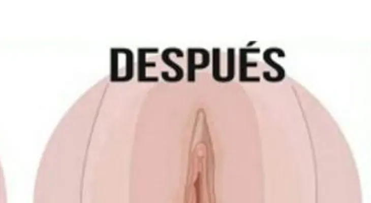 Este es el remedio más eficaz que una cirugía para estrechar la vagina