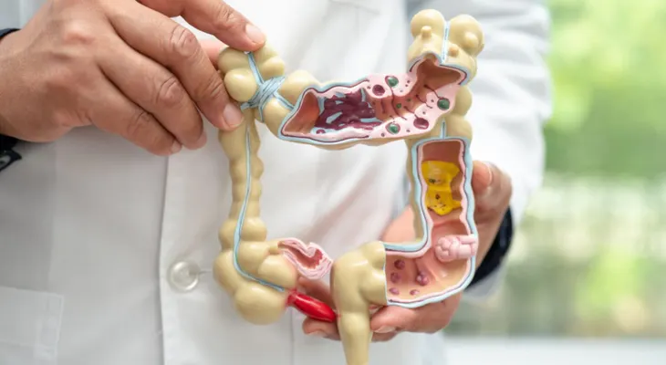 Crohn y colitis ulcerosa: enfermedades crónicas que inflaman el intestino
