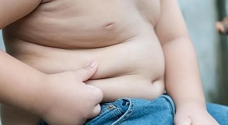  Obesidad mórbida en adolescentes acorta hasta 40 años la esperanza de vida 