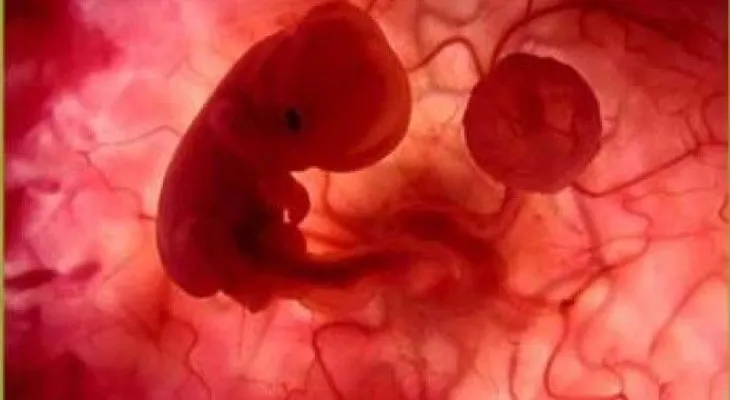 Presentarán ley de despenalización aborto terapéutico en Chile 
