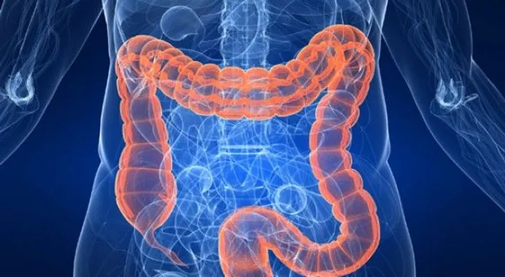 Cáncer rectal: Síntomas, diagnóstico y tratamiento