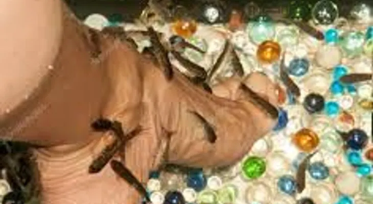 Una mujer pierde las uñas de todos sus pies tras someterse a una pedicura con peces