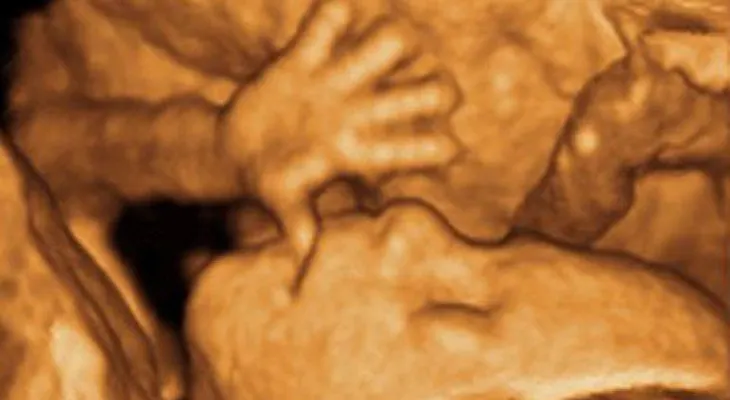 Los "bebés de tres padres" genera polémica en Inglaterra