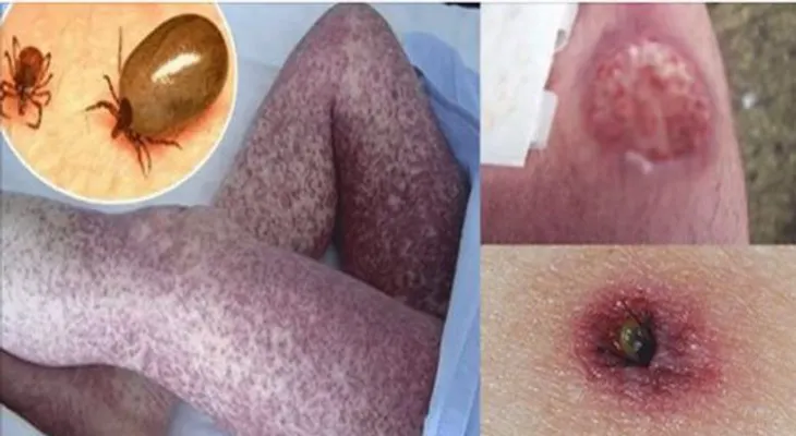 Si te sale sangre por la nariz, te duele la garganta, siente fiebre o dolor en el cuerpo, estaría afectado por una enfermedad de perros y gatos 