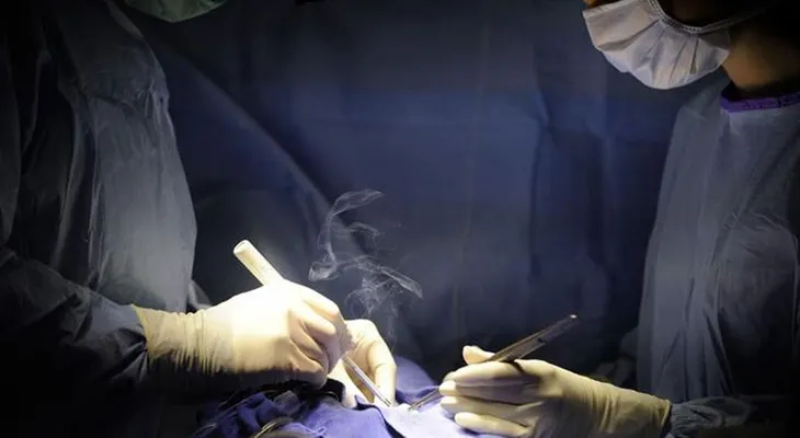 Un cirujano confiesa que grabó sus iniciales en los hígados de pacientes. Bárbaro