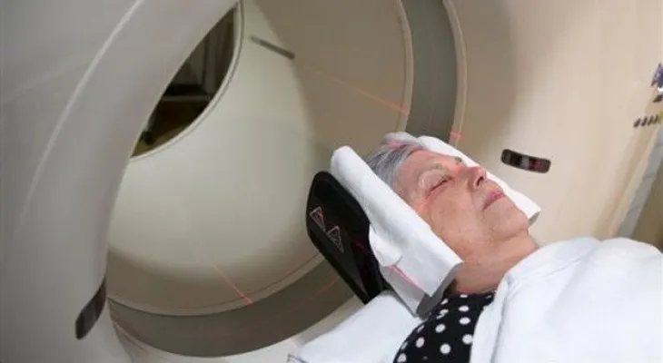 Estudian cerebros sanos en busca de indicios de Alzheimer 