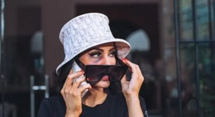 Natti Natasha aparece con fuerte golpe en su rostro