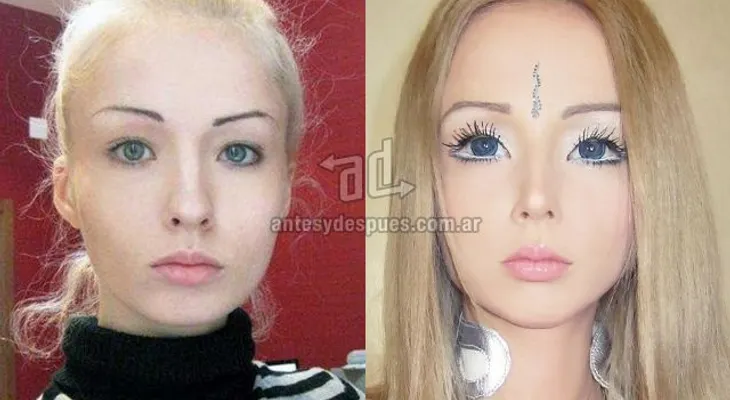 La barbie humana: cómo era antes de su cirugía?