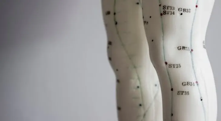 La acupuntura podría no ayudar con el dolor crónico de rodilla