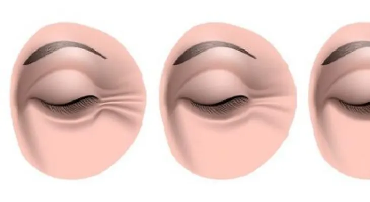 Tres ingredientes naturales para reducir las arrugas de los ojos 