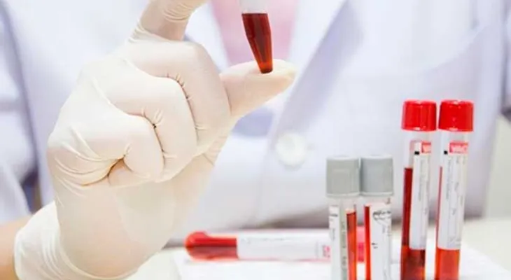 Una molécula de la sangre es efectiva contra enfermedad autoinmune del riñón