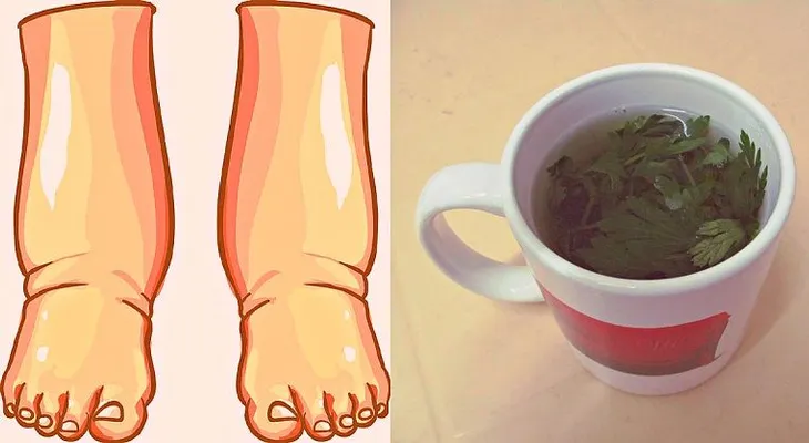 ¡Este es, quizás, el más poderoso remedio natural para aliviar la hinchazón de los pies!