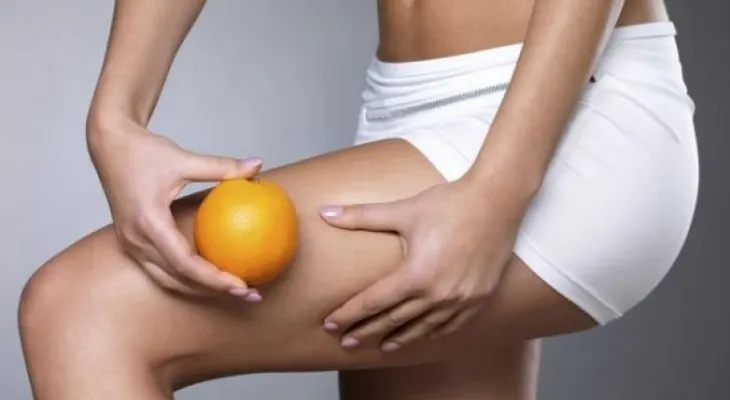 ¡Toma nota! Tratamientos efectivos para la celulitis