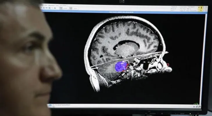 Crean cerebro artificial capaz de aprender por sí mismo