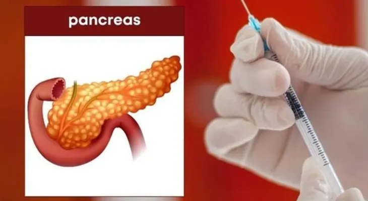 Desarrollan efectiva vacuna contra el cáncer de páncreas