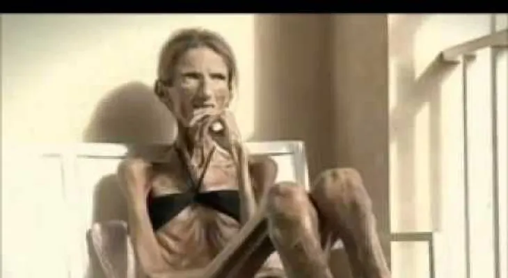 DIOS MIO, nunca intente adelgazar de esta forma: mira el mal estado de esta mujer famosa (VIDEO)
