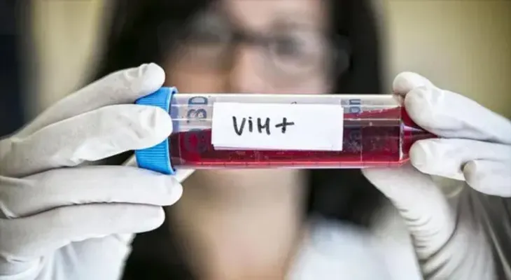 Interrogante ante caso de una argentina que se habría curado del VIH sin tratamiento