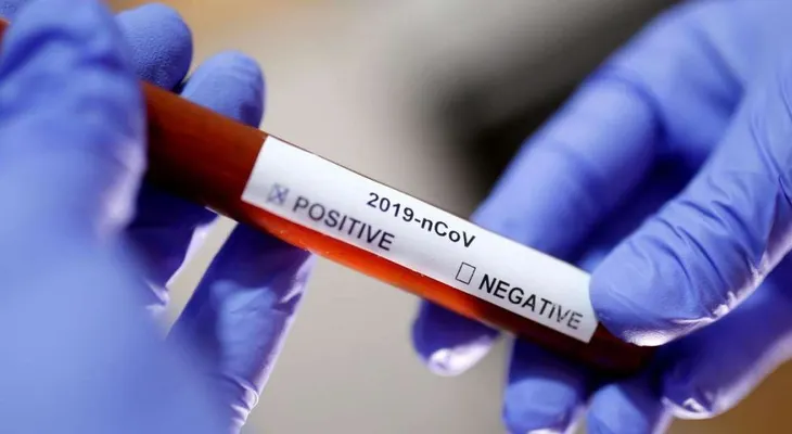 Se incrementa a 520 cantidad de fallecidos por coronavirus en RD; contagiados 18,319