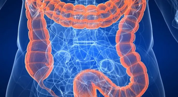 Mucha carne y poca fibra, combinación riesgosa para el colon