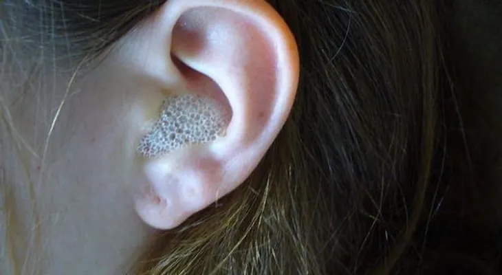 ¡Sólo 3 gotas de este remedio en el oído, dan un efecto increíble!
