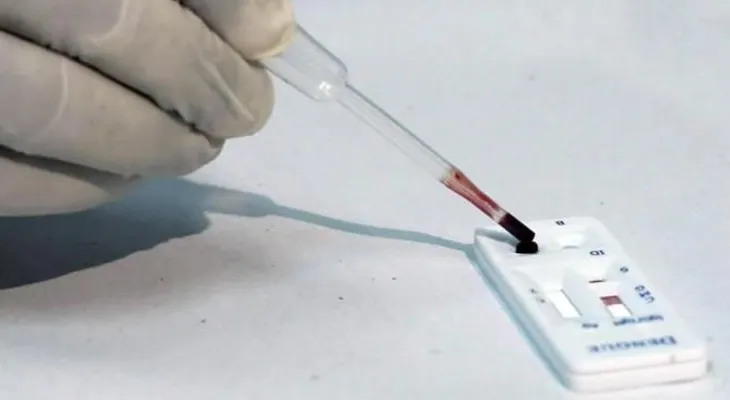 OMS dice test de diagnóstico de Zika podría estar disponible en semanas