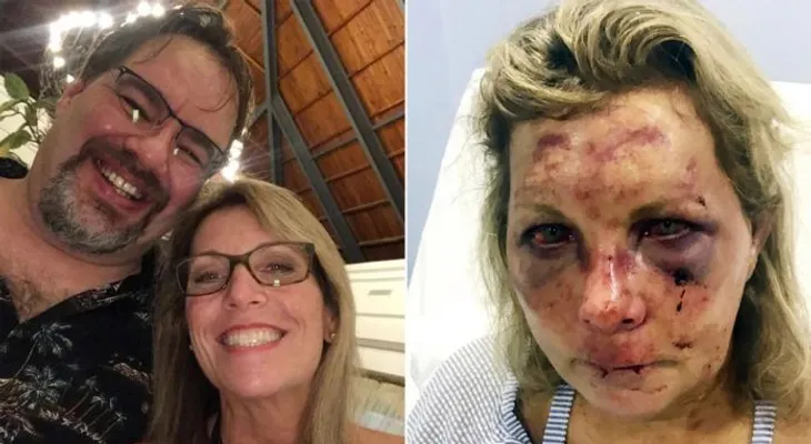 Esposo de turista masacrada: Autoridades de RD se negaron a investigar el hecho; ahora hablan mentiras