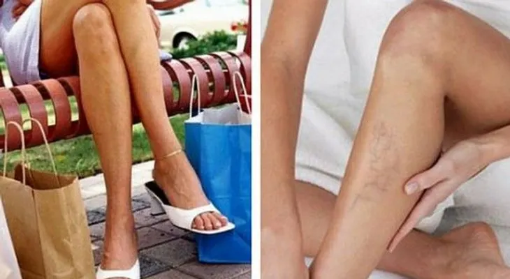 Esta es la razón por la que cruzar las piernas está perjudicando tu salud