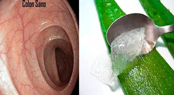 Esta es la forma correcta de preparar gel de aloe vera para una limpieza de colon
