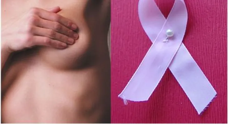 40 mil mujeres, entre ellas dominicanas, mueren en EEUU por cáncer de seno