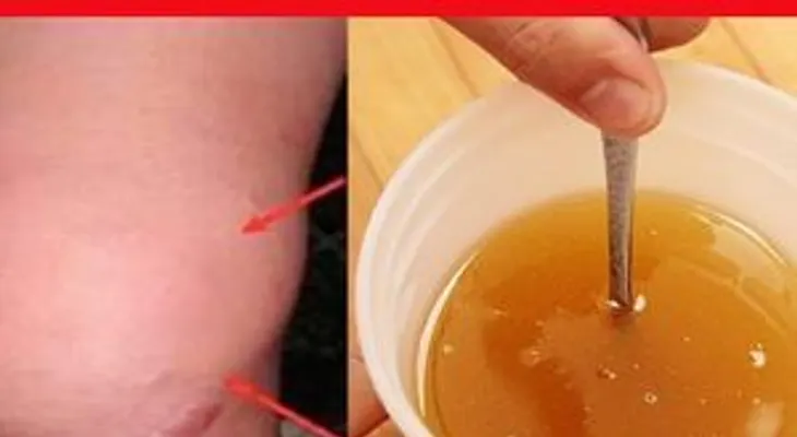 Esta es la mejor receta para sanar tus rodillas y reconstruir huesos y articulaciones