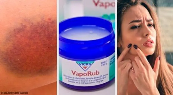 El VICKS VAPORUB y sus increíbles usos hasta en la vida sexual. Ver enlace del video