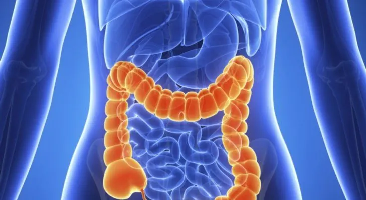 Cáncer de colon es la 4ta muerte por enfermedad oncológica